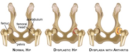 hip dysplasia in dogs diagram of hip bones