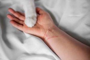 person holding cat paws checking for ticks