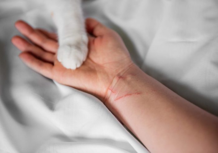 person holding cat paws checking for ticks